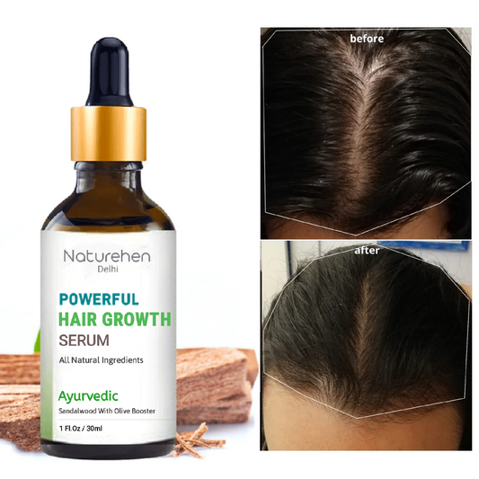 Extraordinary Naturehen Hair oil serum for Men and Women dry rough hair (30 ml)
